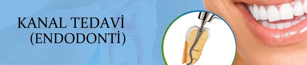 kanal tedavi