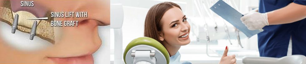 sinus lifting