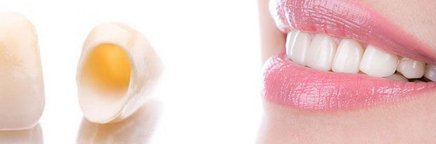 zirkonyum diş protez